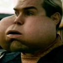 Man with extremely swollen, bloated cheeks looking forward with a shocked expression.